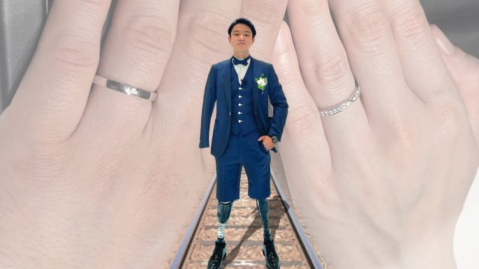 【祝福】20歳で両足と両手を失ったYouTuber・山田千紘が結婚！