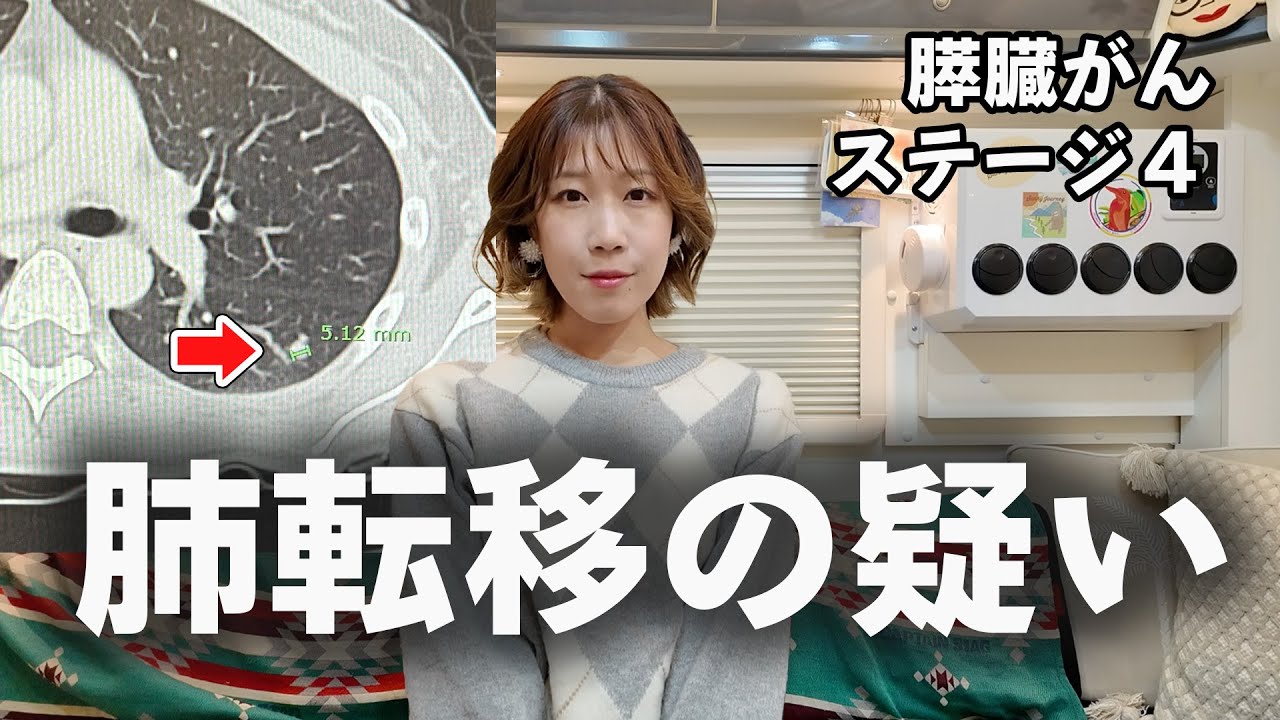 サニージャーニー