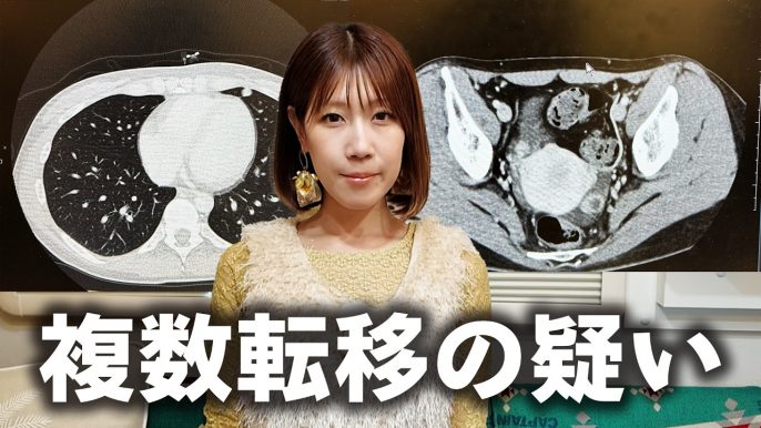 サニージャーニー