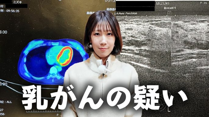 サニージャーニー